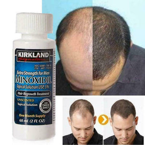 Mioxidil Kirkland